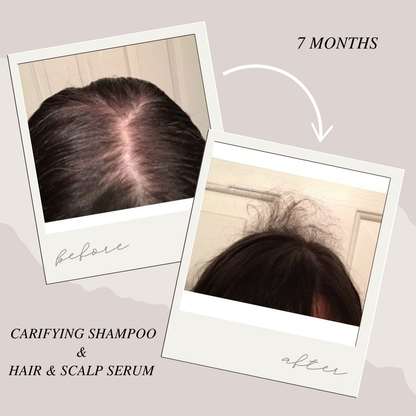 Hair and Scalp Stimulating Serum