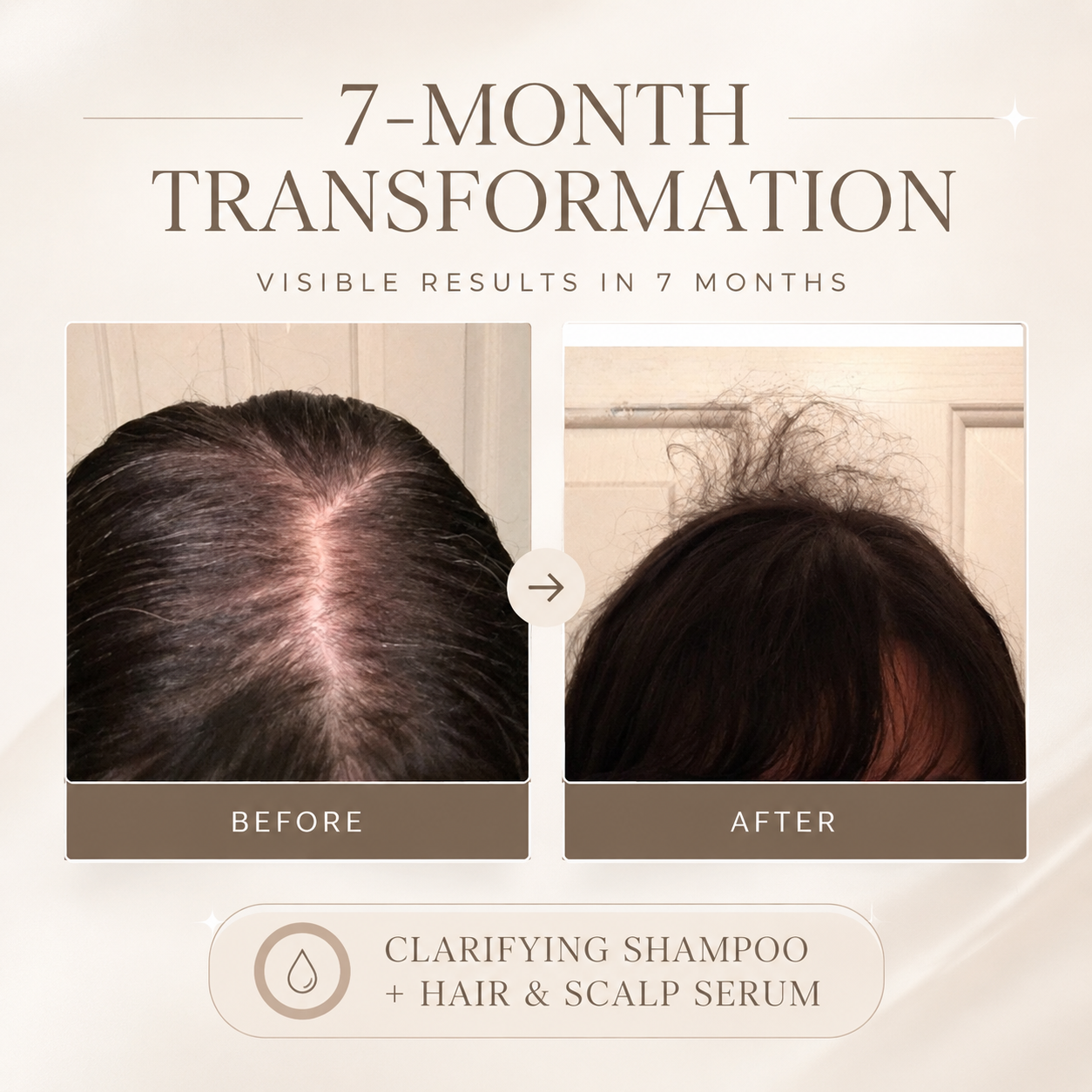 Hair and Scalp Stimulating Serum My Hair Dance